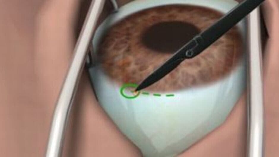 Surgery Simulator