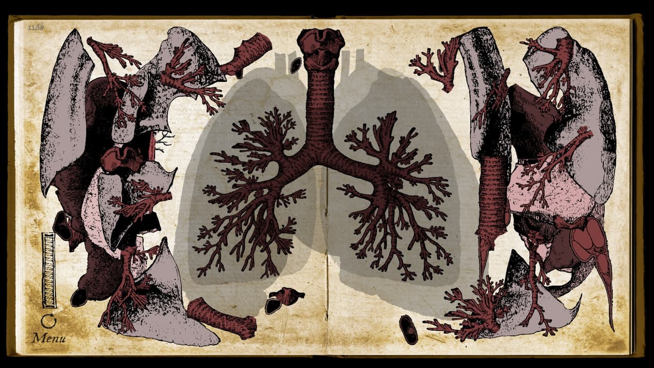 Wound Man screenshot 5