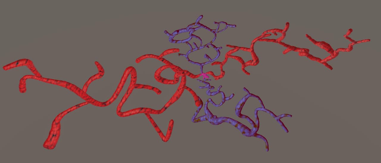 The Maze of a Bloodstream screenshot 6
