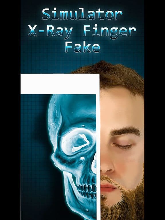 Simulator X-Ray Bone Fake screenshot 2