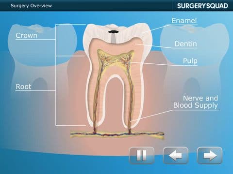 Surgery Squads Virtual Root Canal Procedure screenshot 5
