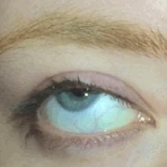 Hall of Eyeballs