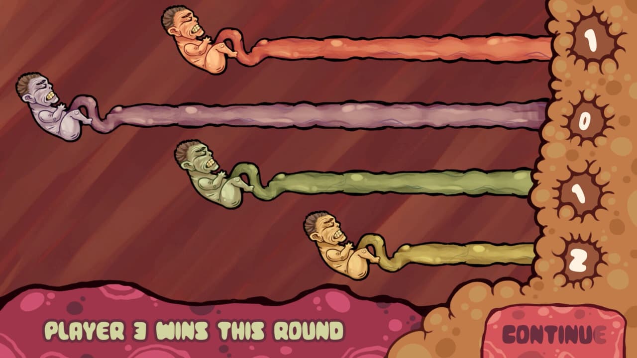 Foetality: Fetus Deletus