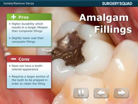 Surgery Squads Dental Filling screenshot 4