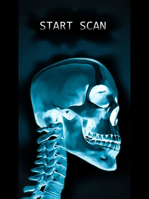 Simulator X-Ray Bone Fake screenshot 3