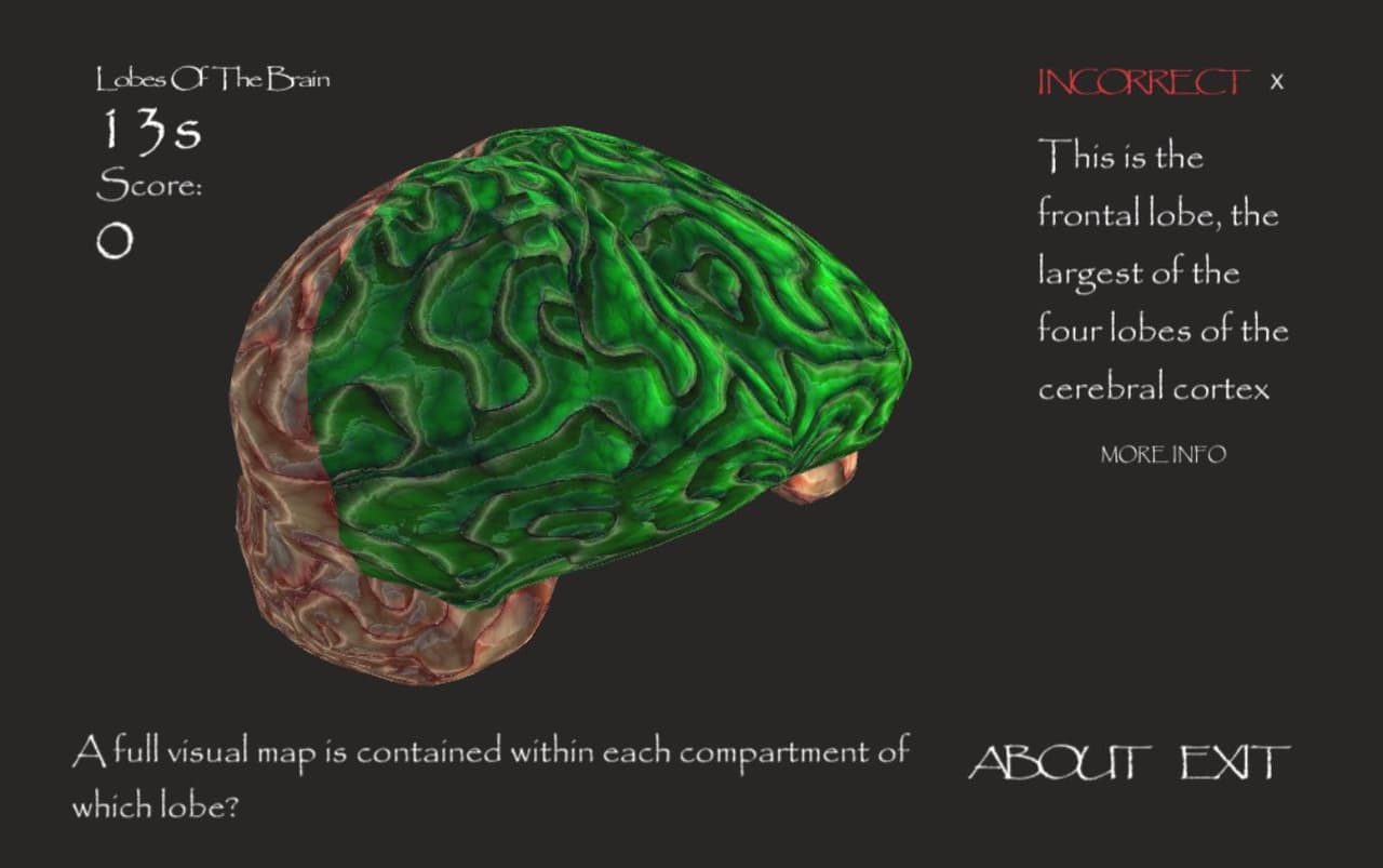 Lobes Of The Brain screenshot 2