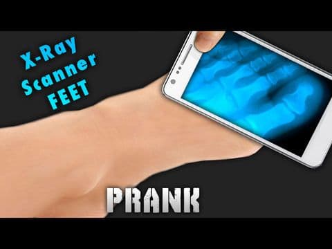 Simulator X-Ray Feet