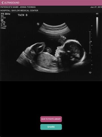 Ultrasound Spoof 2016: Pregnancy Test screenshot 2