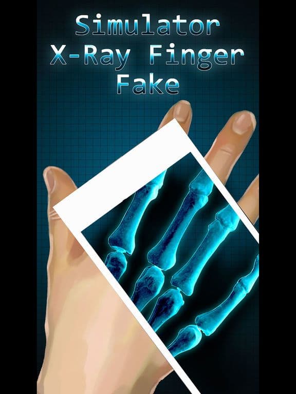 Simulator X-Ray Bone Fake