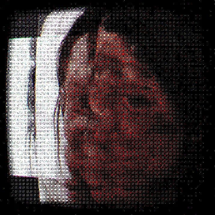 prosopagnosia