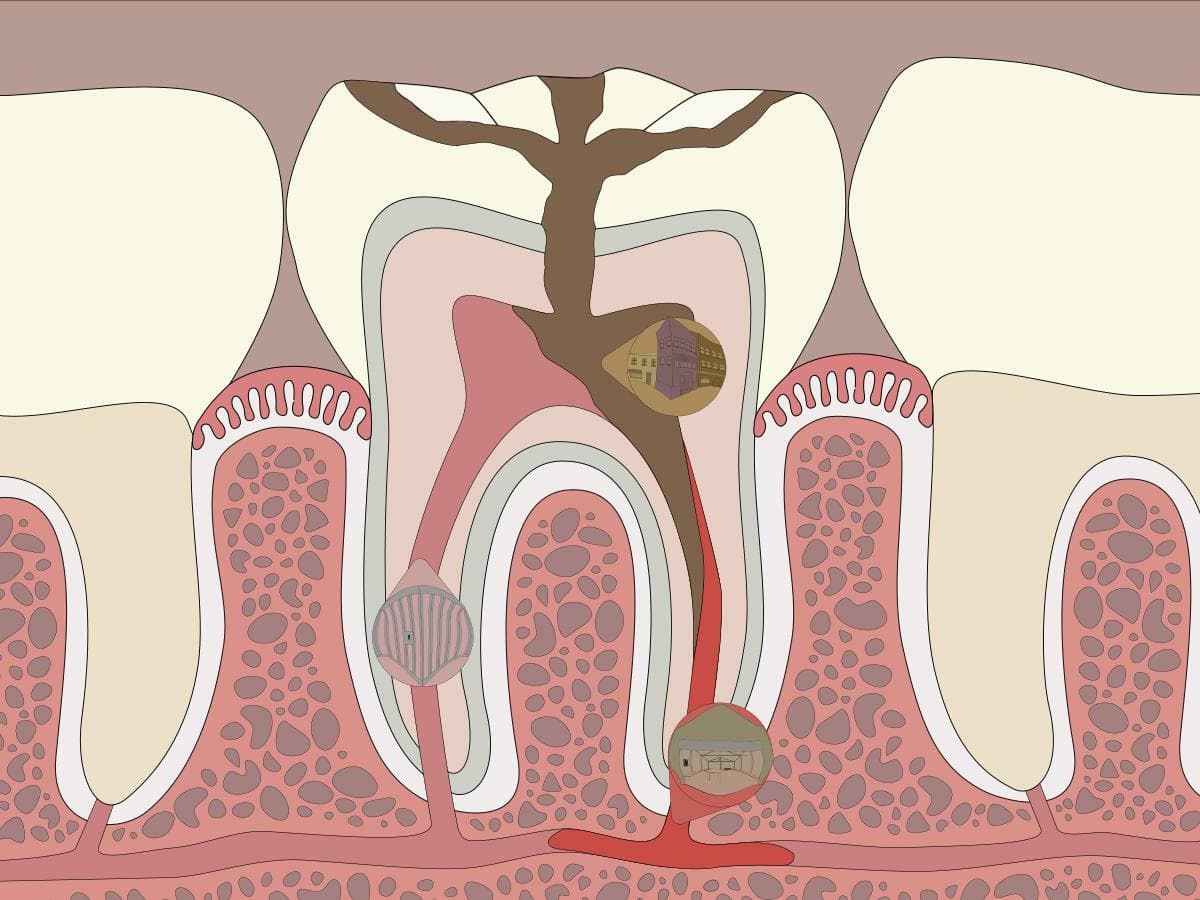 Microinvasión screenshot 3