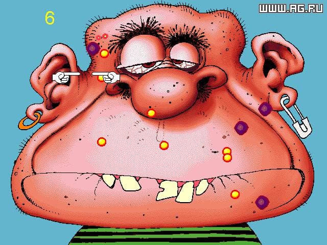 Acne Attack!