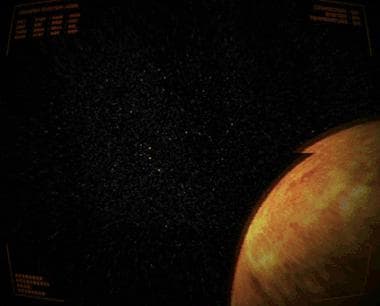 Space Camera