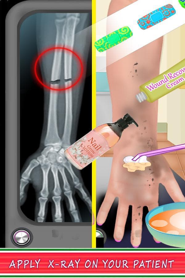 Arm Surgery Doctor screenshot 6