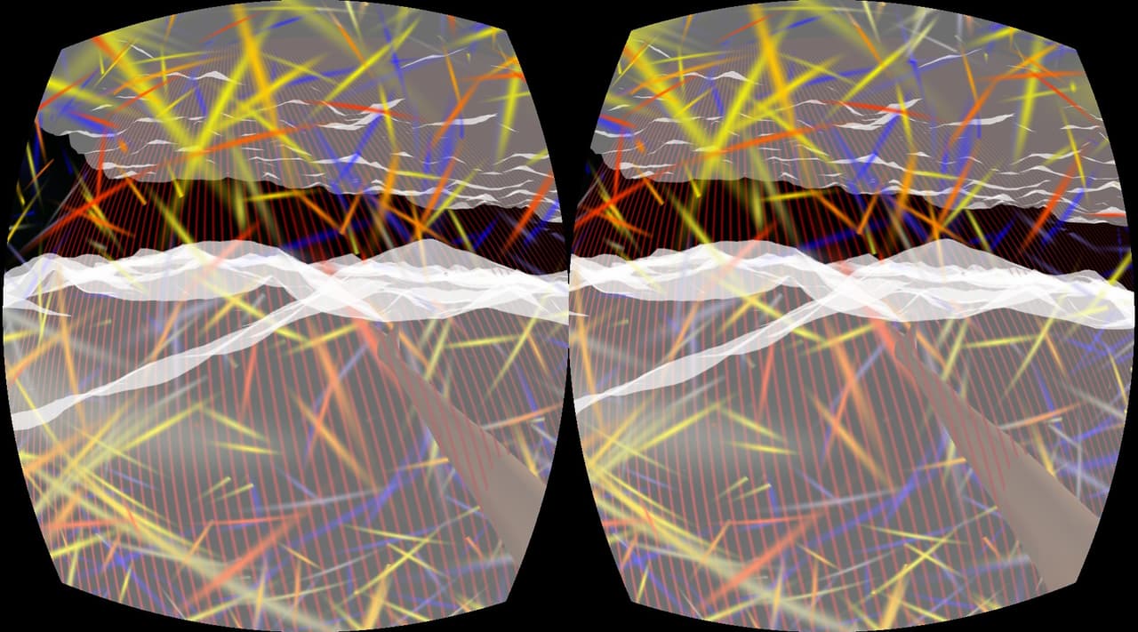 Brain dump