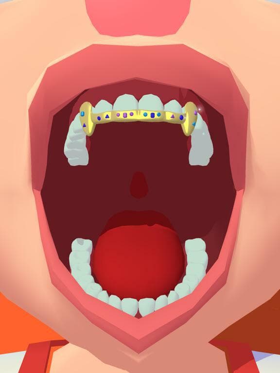 Gold Grillz