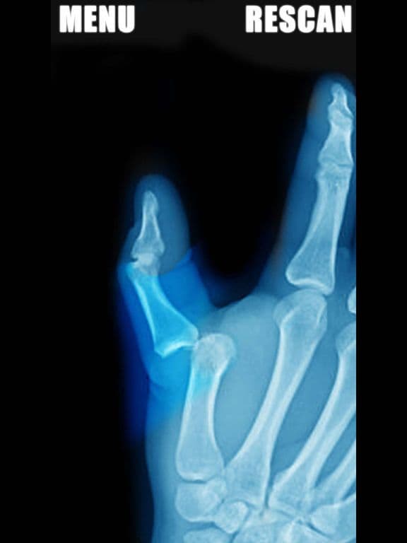 Simulator X-Ray - Finger Prank screenshot 2