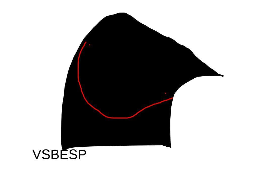 vs besp