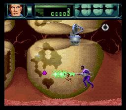 Rex Ronan: Experimental Surgeon screenshot 5