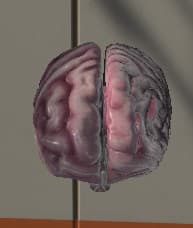 Surgical Study and 3D Skeletons for Medical School Students screenshot 3
