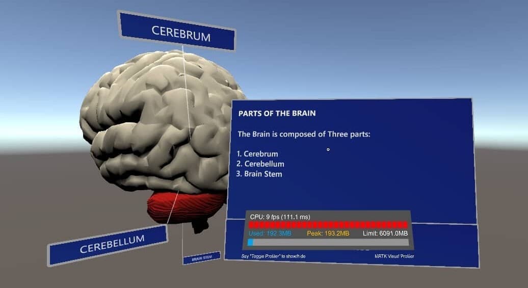 BrainMR