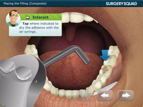 Surgery Squads Dental Filling