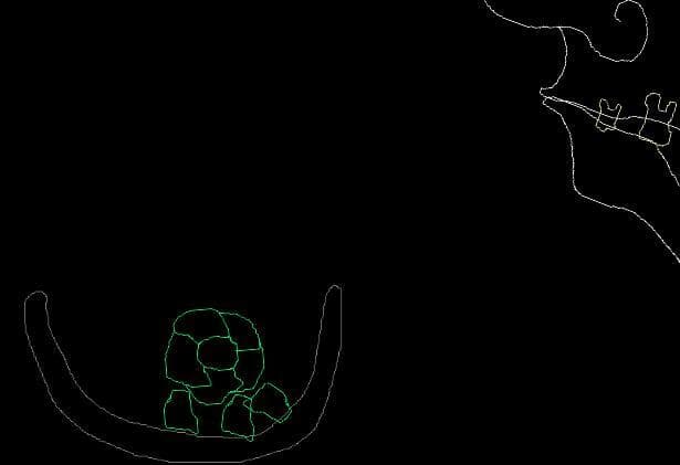 Teeth Simulator