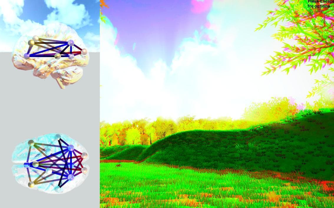 LSD and the brain screenshot 4