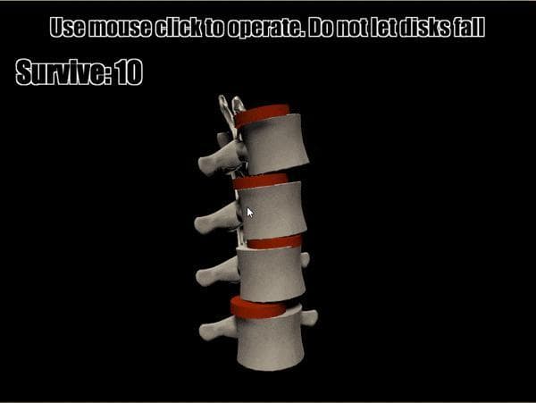 Repairing humans: The spinal battle. screenshot 2