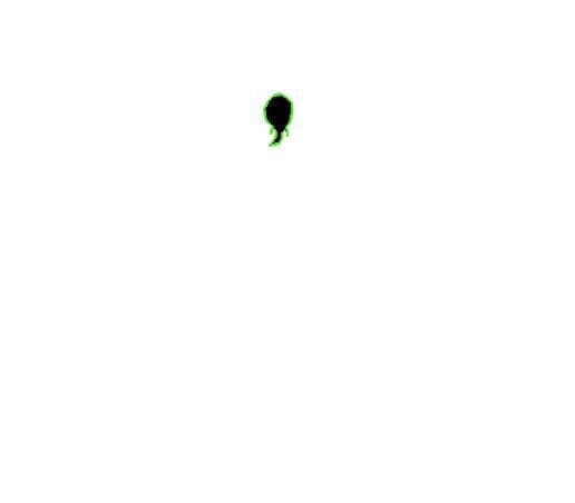 Tadpoles (Ratima Chandrema)