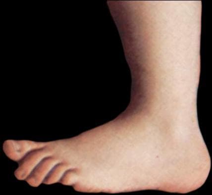 Epic Tickly Feet