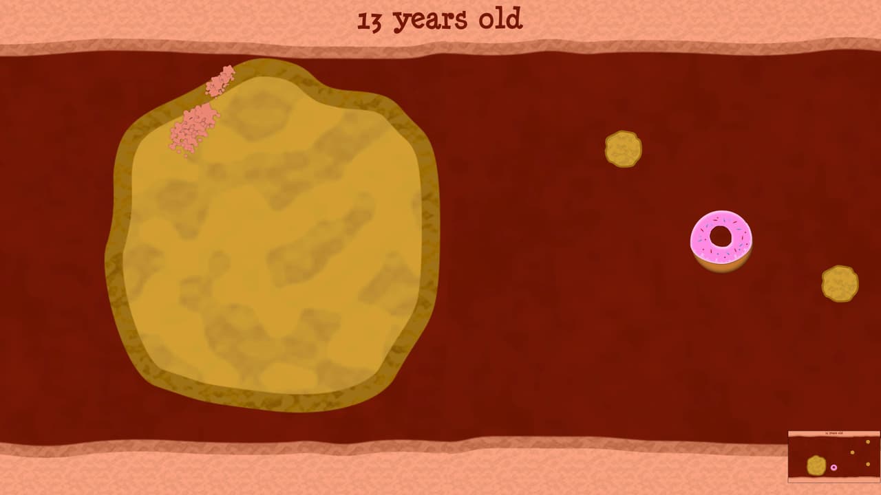 Cholesterol