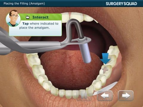 Surgery Squads Dental Filling screenshot 2