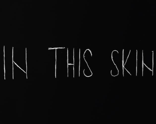 In this skin