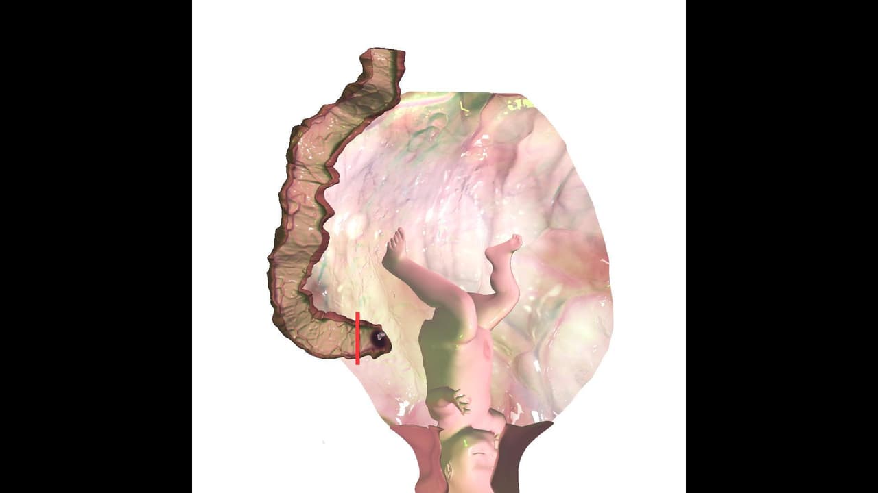 Ƀ@ɃØɌŦƗØN