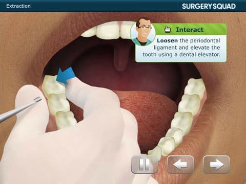 Surgery Squads Wisdom Tooth Extraction screenshot 2