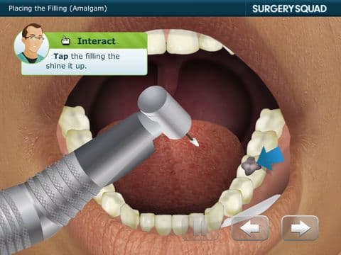 Surgery Squads Dental Filling screenshot 5