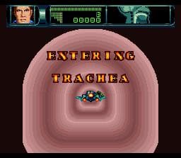 Rex Ronan: Experimental Surgeon screenshot 6